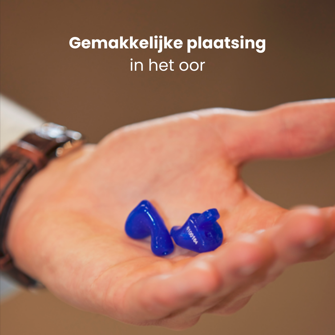 HARDE OTOPLASTIEKEN